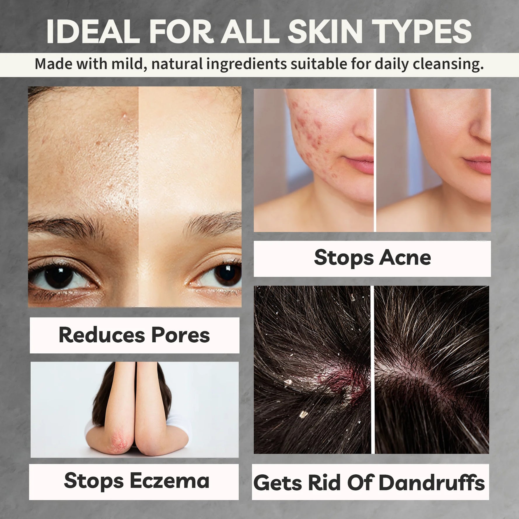 Product advertisement showing skin before and after use, with text highlighting benefits for various skin conditions.